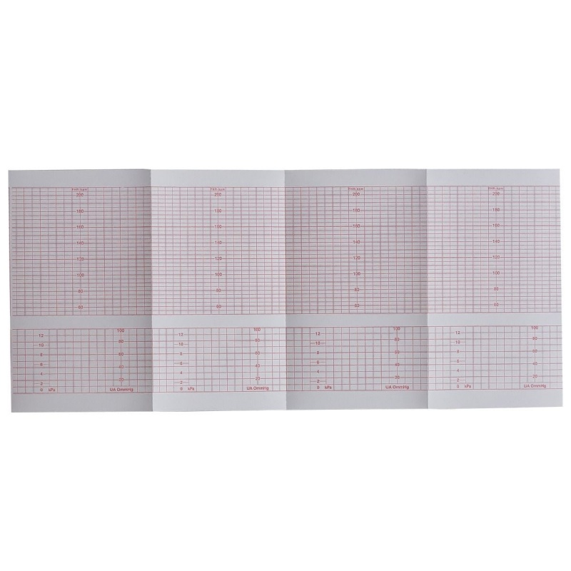 Hartie EKG la blat - 152 x 90 mm x 150 file caroiata 2