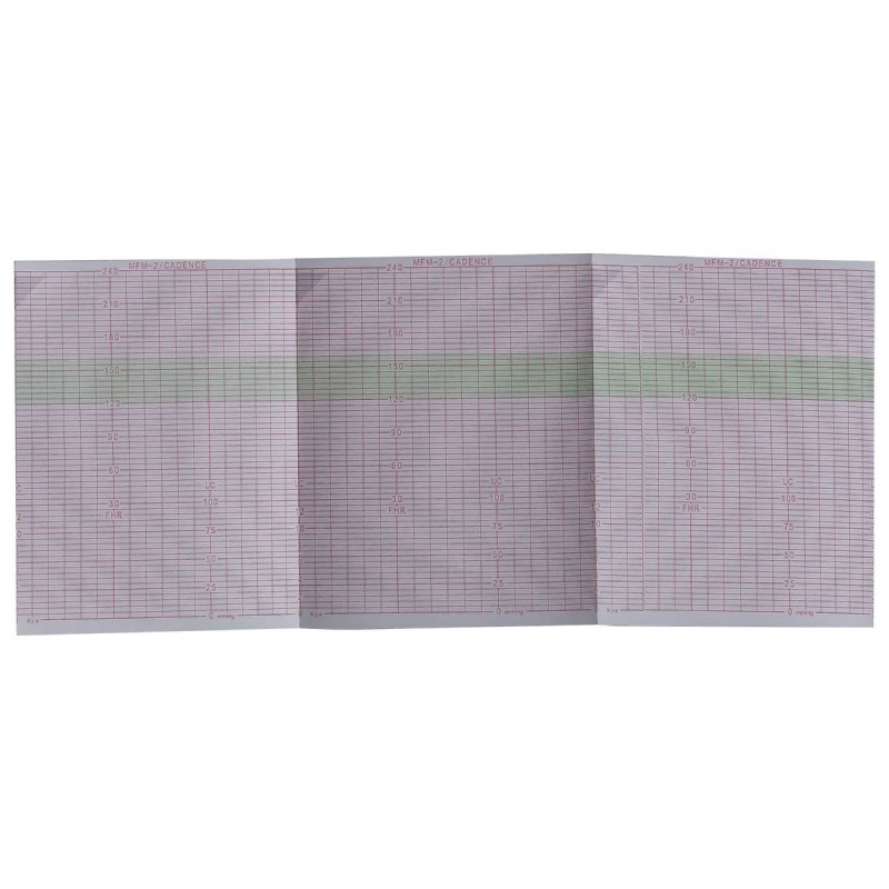 Hartie EKG la blat - 112 x 90 mm x 150 file caroiata 2